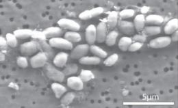 Bacteria GFAJ-1